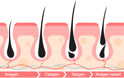 Electrolysis Permanent Choice Permanent Choice Laser Hair